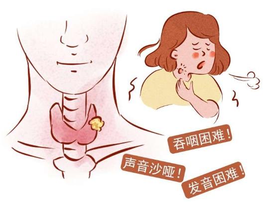 慢性咽炎的预防措施