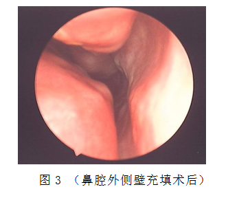 重庆耳鼻喉医院哪家好