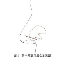重庆治疗耳鼻喉的医院