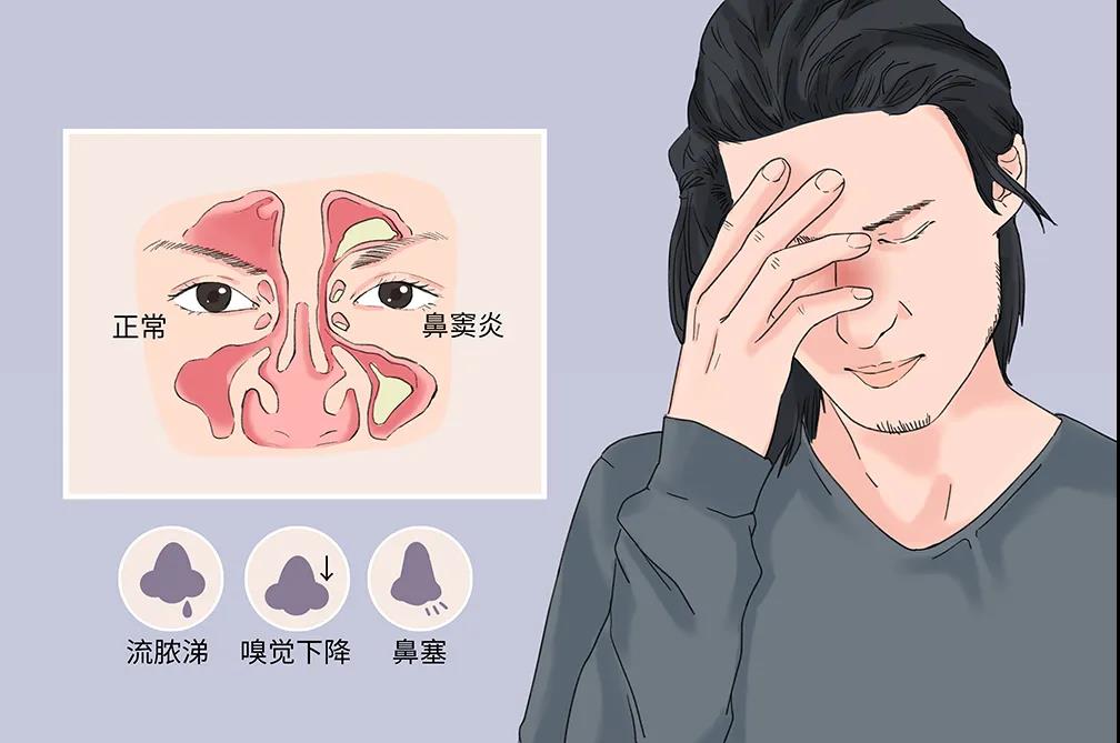 鼻窦炎医院