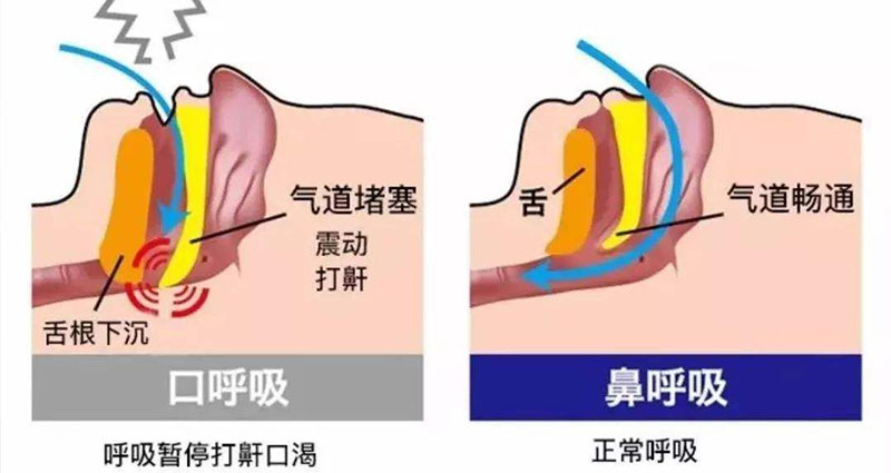 睡觉打鼾